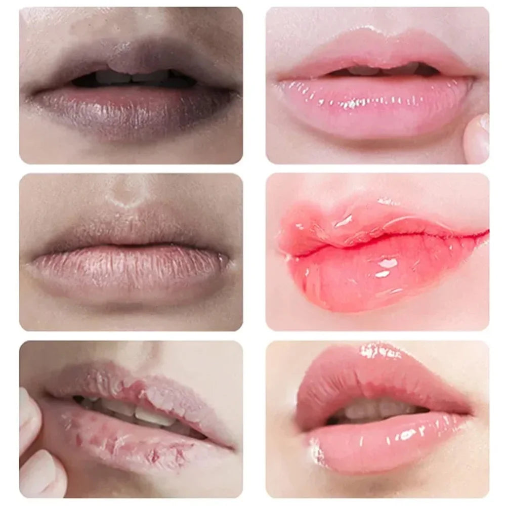 Lip Lightening Balm