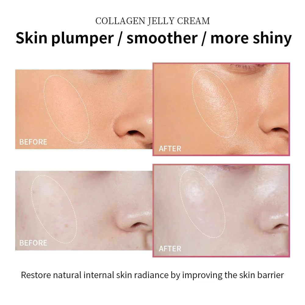 Niacinamide Collagen Jelly Cream