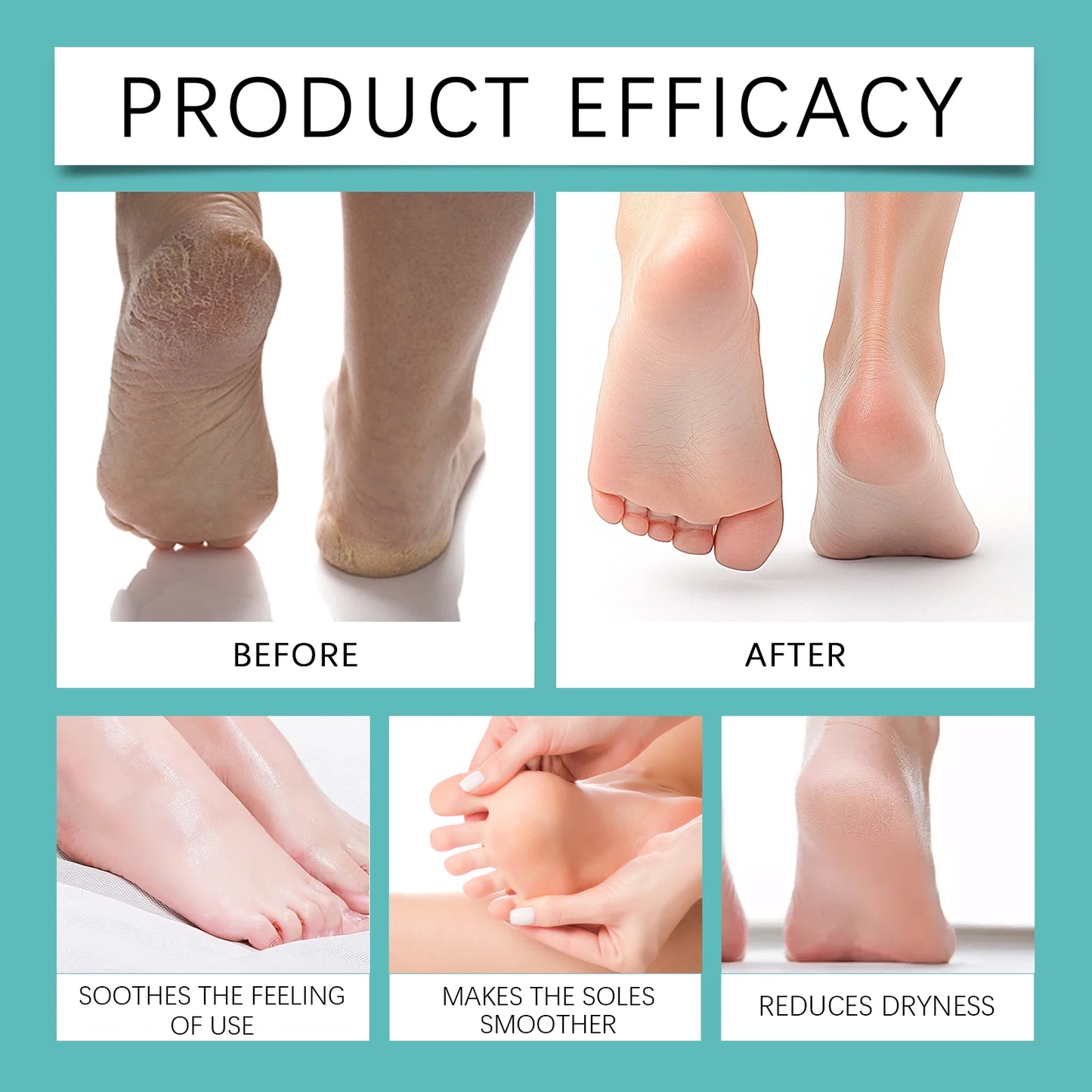 Foot Peeling Spray Instantly Remove Dead Skin Calluses Moisturizing Nourish Dry Cracked Rough Heels Exfoliating Foot Serum 20ml
