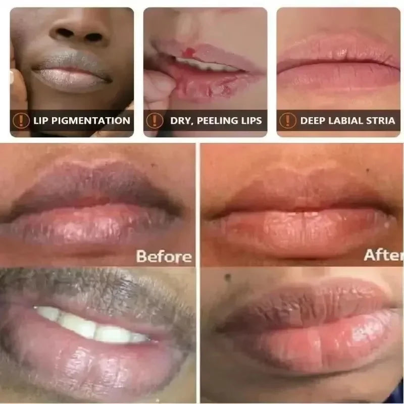 Dark Lip Lightening Balm