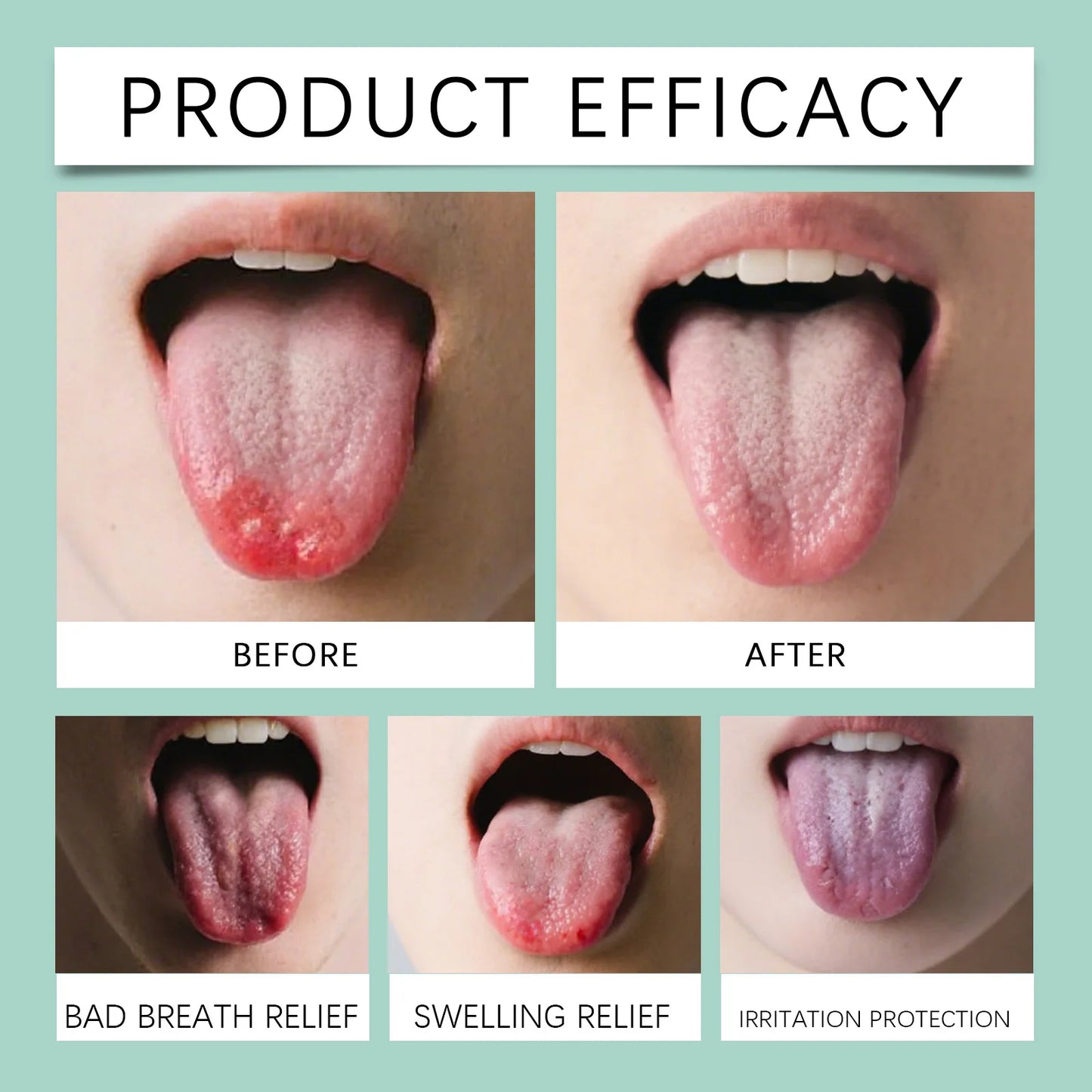 Fissured Tongue Relief & Bad Breath Spray - Reduce Swelling Soothe Tongue Prevent Oral Ulcer Fast-Acting Oral Hygiene Spray 30ml