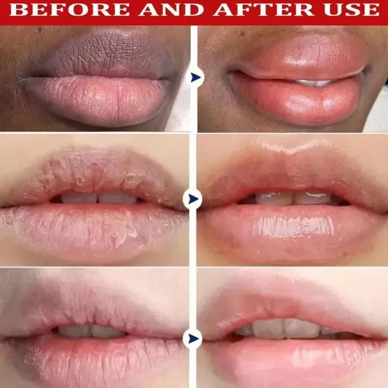Dark Lip Lightening Balm