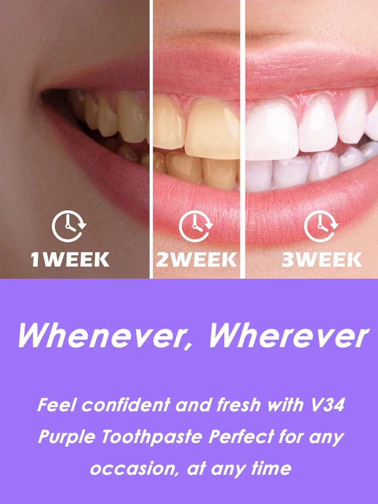 V34 Dental Whitening Toothpaste Instant Teeth Whitener Cleaning Tooth Stain Tartar Cleaner Oral Hygiene Fresh Breath