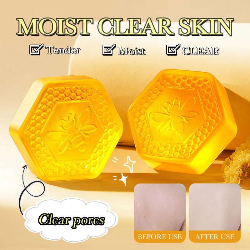 BIOAOUA Vitamin E Honey Essential Oil Soap - Gentle Cleansing Facial & Body Wash, Moisturizing Hydrating Fragrant Bath Soap, Nat