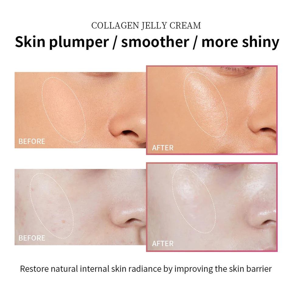 Niacinamide Collagen Jelly Cream